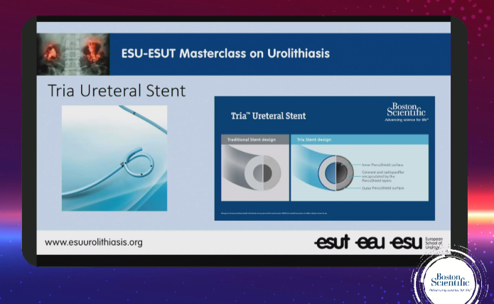 bsc_urology's tweet photo. During #esurolithiasis21 Masterclass: @SeckerArmin discusses challenging flexible treatment of stones in horseshoe kidney w/ Lithovue Empower and TRIA stent. #stonesmart.

More on LithoVue Empower: https://t.co/vR4GFmVzvC
And on Tria stent: https://t.co/w1XgDTI5UP https://t.co/jz3nErRrSE