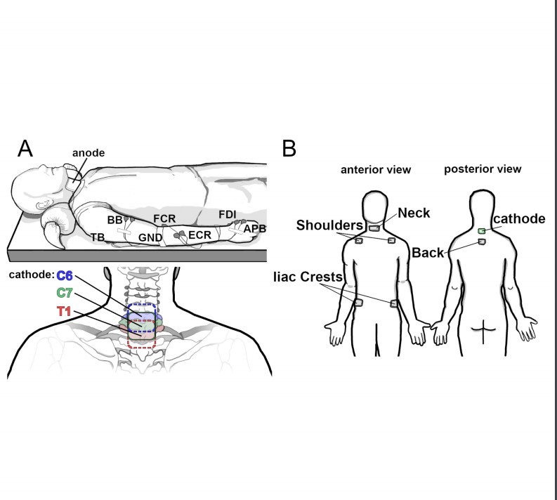 japplphysiol's tweet photo. #ArticleInPress: “Selectivity and excitability of upper-limb muscle activation during cervical transcutaneous spinal cord stimulation in humans” 
By: Roberto M. de Freitas, et al. 
https://t.co/ZDf1u7OOvr
#JAPPL #UpperLimbs #Cervical @matijam_PhD @rm_defreitas https://t.co/StB4TY0vJq