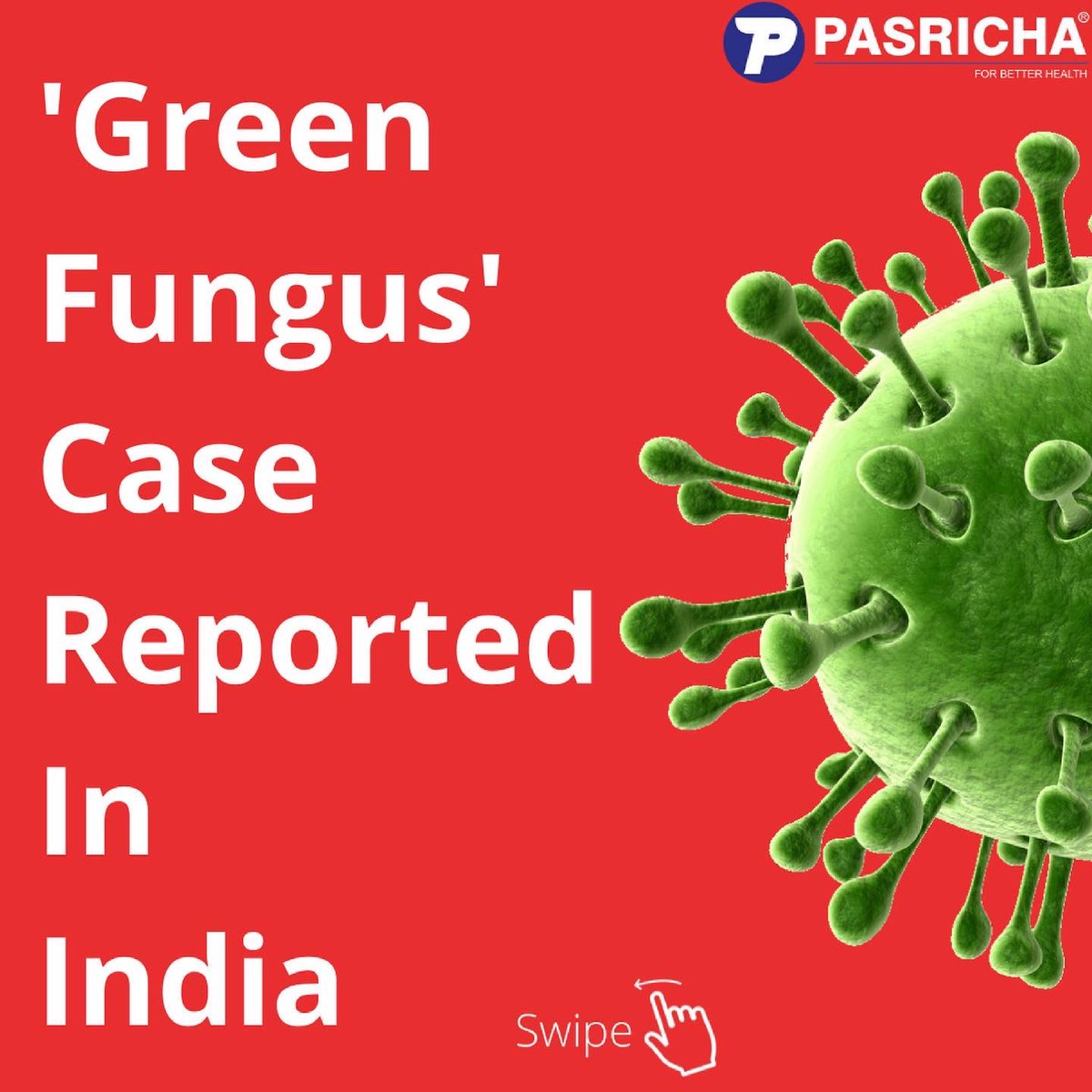 ThePasricha's tweet photo. Green Fungus case reported in India. 
#GreenFungus #Aspergiollosis #Aspergillus #Virus #Covid #Covid_19 #corona #coronavirus #Medical #Health #Hospital #Doctor #Love #Wellness #Hospital #Mbbs #HealthyLifestyle #Healthy #Med #Pasricha #ForBetterHealth https://t.co/PRZfJJXdBV