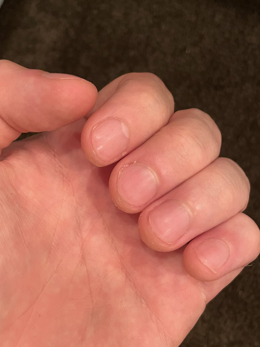 優里 うわっ 爪切りすぎた 優里 うわっ 爪切りすぎた