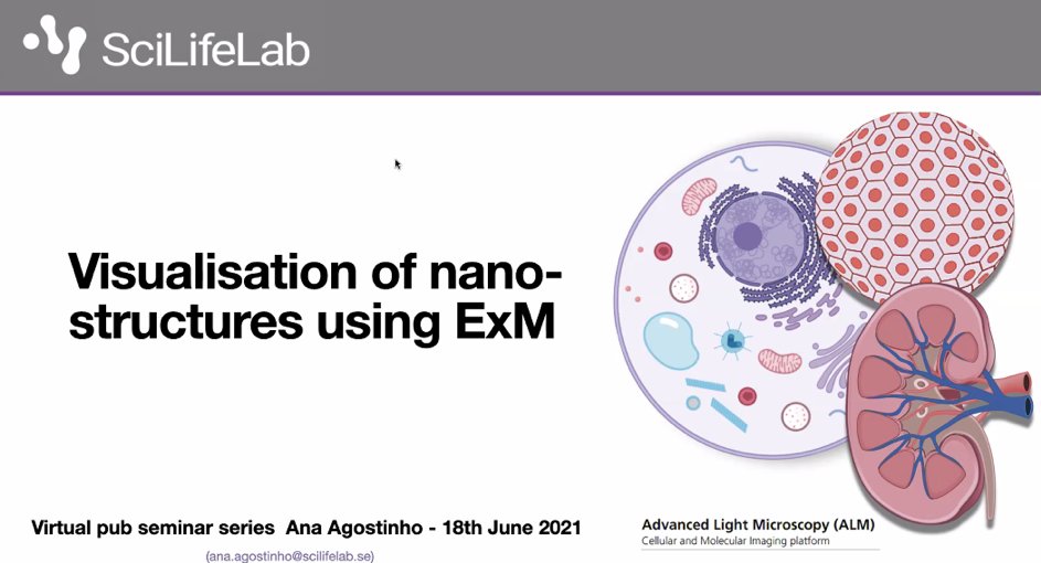 Euro-BioImaging ERIC (@eurobioimaging) on Twitter photo At today’s Virtual Pub Ana Agostinho <a href="/A_R_Agostinho/">Ana Agostinho</a> and Steven Edwards shared the benefits of expansion microscopy with us and revealed some of their tricks.
If you want to learn more, here’s a recent article: pubmed.ncbi.nlm.nih.gov/33195398/ At today’s Virtual Pub Ana Agostinho <a href="/A_R_Agostinho/">Ana Agostinho</a> and Steven Edwards shared the benefits of expansion microscopy with us and revealed some of their tricks.
If you want to learn more, here’s a recent article: pubmed.ncbi.nlm.nih.gov/33195398/