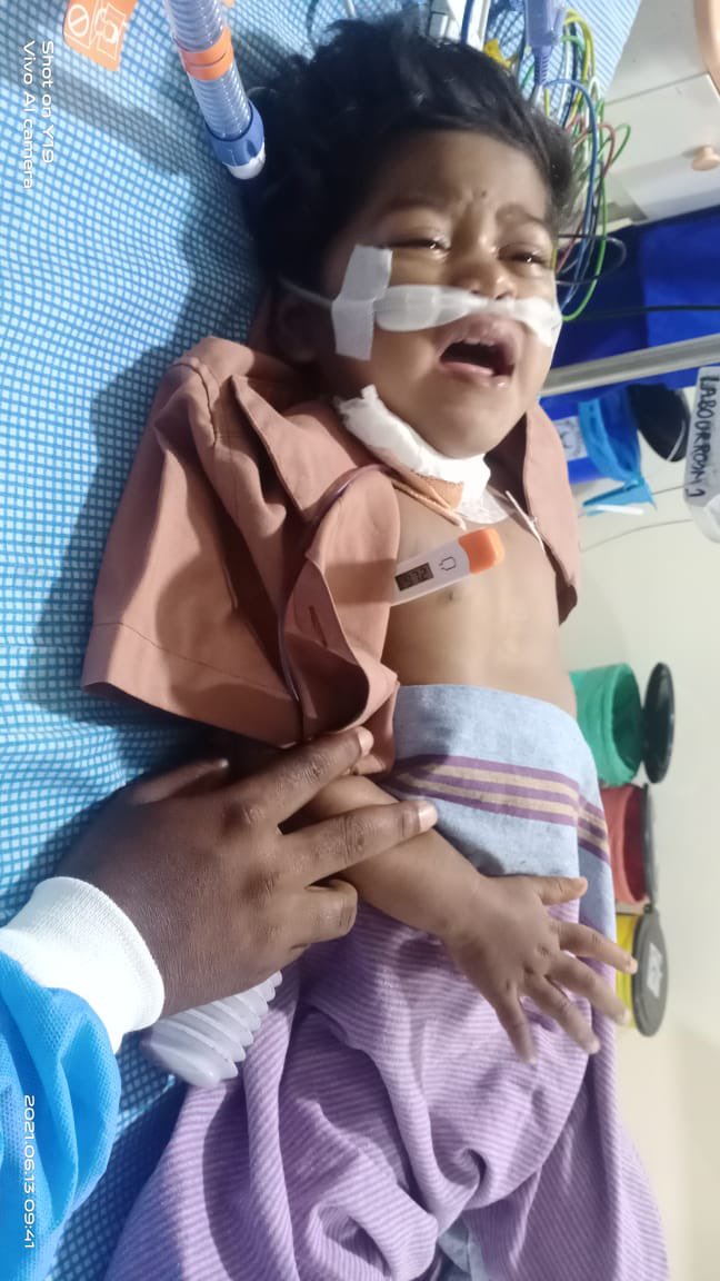 KTRBRS's tweet image. Happy to share this news as a follow up 😊

As promised, we ensured that little Akshaya’s surgery has been performed. Now she is back home with her parents &amp;amp; delighted that she is recovering well