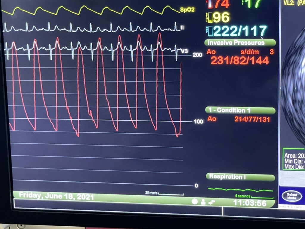 Amir Kaki, MD tweet media