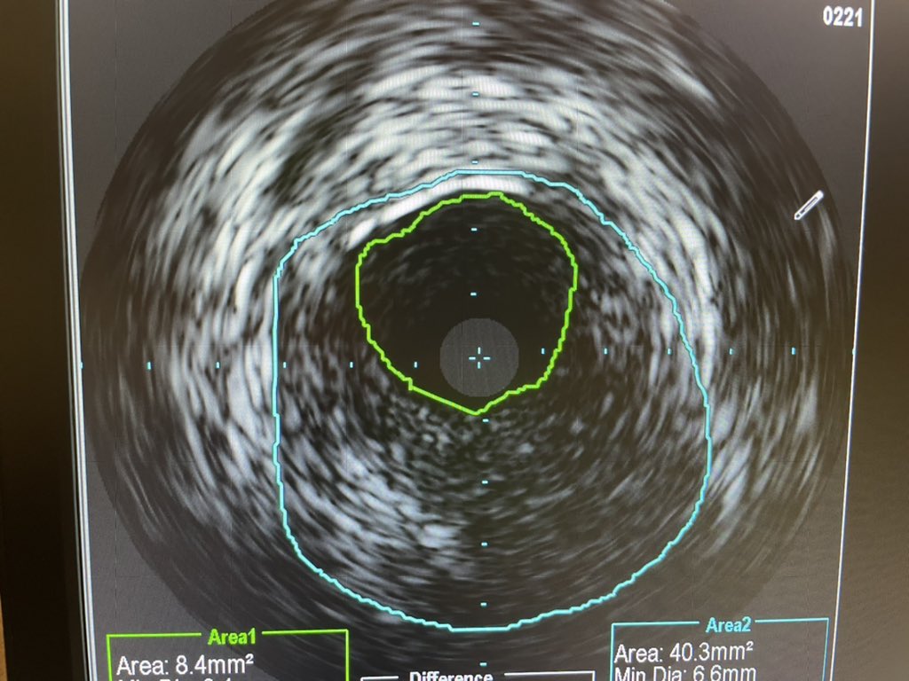 Amir Kaki, MD tweet media