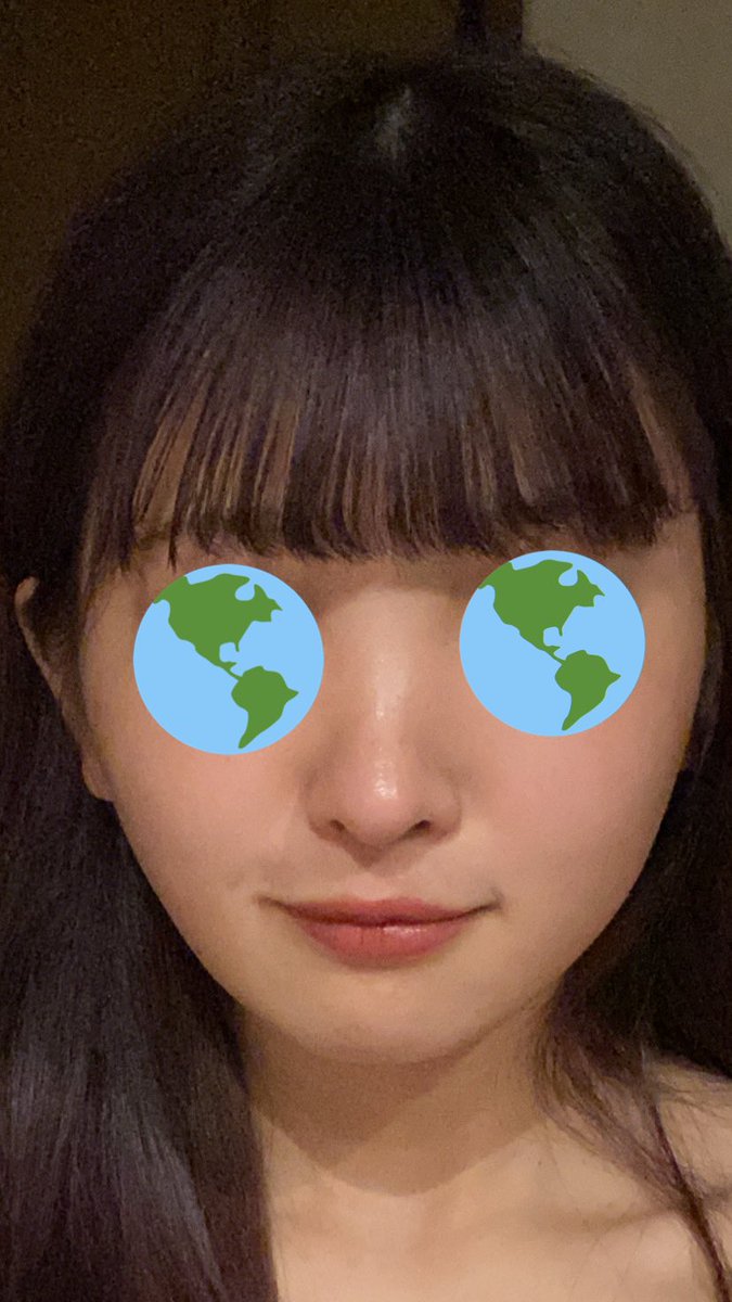 zooczoczoc's tweet photo. 腫れの引きは人それぞれだけど4ヶ月でここまで落ち着くから鼻整形した人は気長に待って見てほしい₍ᐡඉ ̫ ඉᐡ₎先生曰く、私は腫れがかなり強い方らしいです😭
全てメイクなどしてなく、ノーマルカメラです！
1枚目:1週間後(溶ける糸が出てるのは気にしないでください笑)
2枚目:1ヶ月後
3枚目:4ヶ月後 https://t.co/C40RnN6pwq