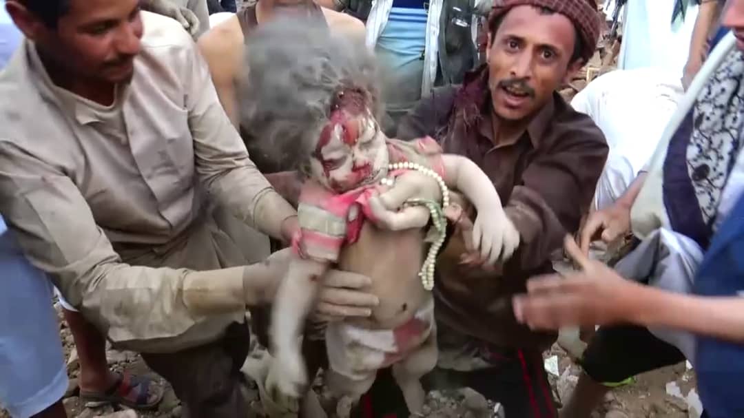 Moh_Alhouthi's tweet photo. هؤلاء لم تقم الامم المتحدة ولا غوتريش باي اجراء ضدهم 
والاف ممن قتلهم عدوان امريكا وبريطانيا والسعودية والإمارات وحلفائهم

انشروا صور جرائم العدوان في كل موقع وصفحة ومع كل تغريدة او منشور
خلال الايام والساعات القادمة 
وافضحوا غوتيريش والامم المتحدة 
للعالم

#اليمن_سيدا_بجمهوريته https://t.co/dLrdZNgyUD