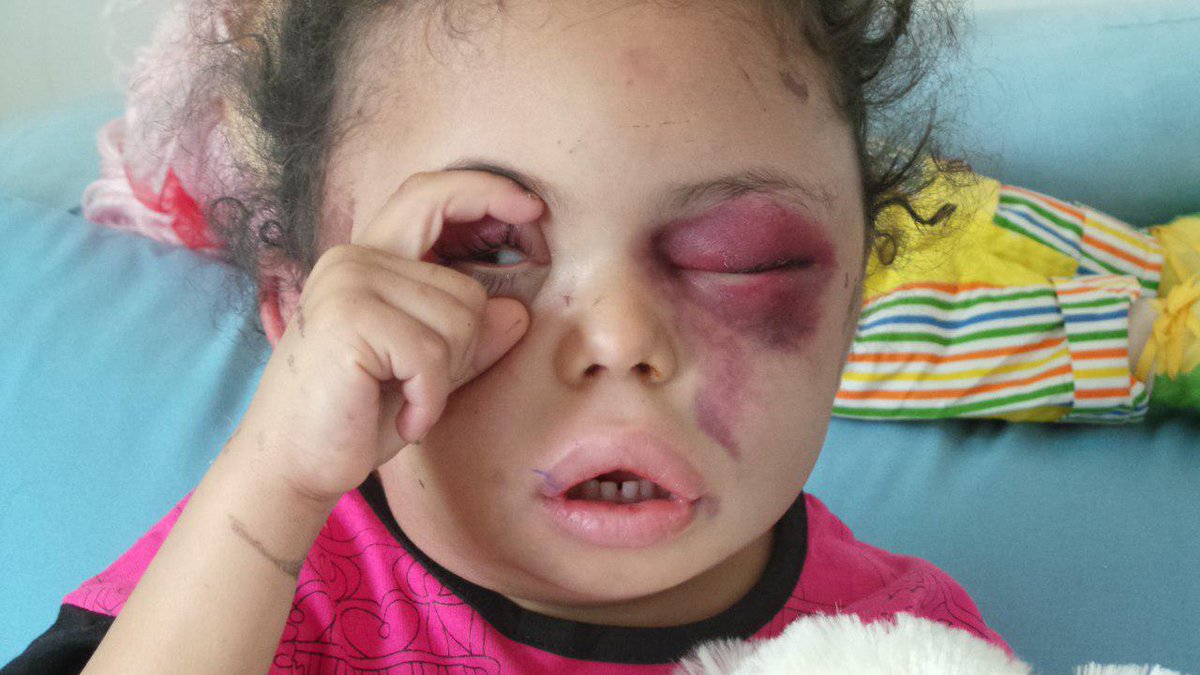 Moh_Alhouthi's tweet photo. هؤلاء لم تقم الامم المتحدة ولا غوتريش باي اجراء ضدهم 
والاف ممن قتلهم عدوان امريكا وبريطانيا والسعودية والإمارات وحلفائهم

انشروا صور جرائم العدوان في كل موقع وصفحة ومع كل تغريدة او منشور
خلال الايام والساعات القادمة 
وافضحوا غوتيريش والامم المتحدة 
للعالم

#اليمن_سيدا_بجمهوريته https://t.co/dLrdZNgyUD