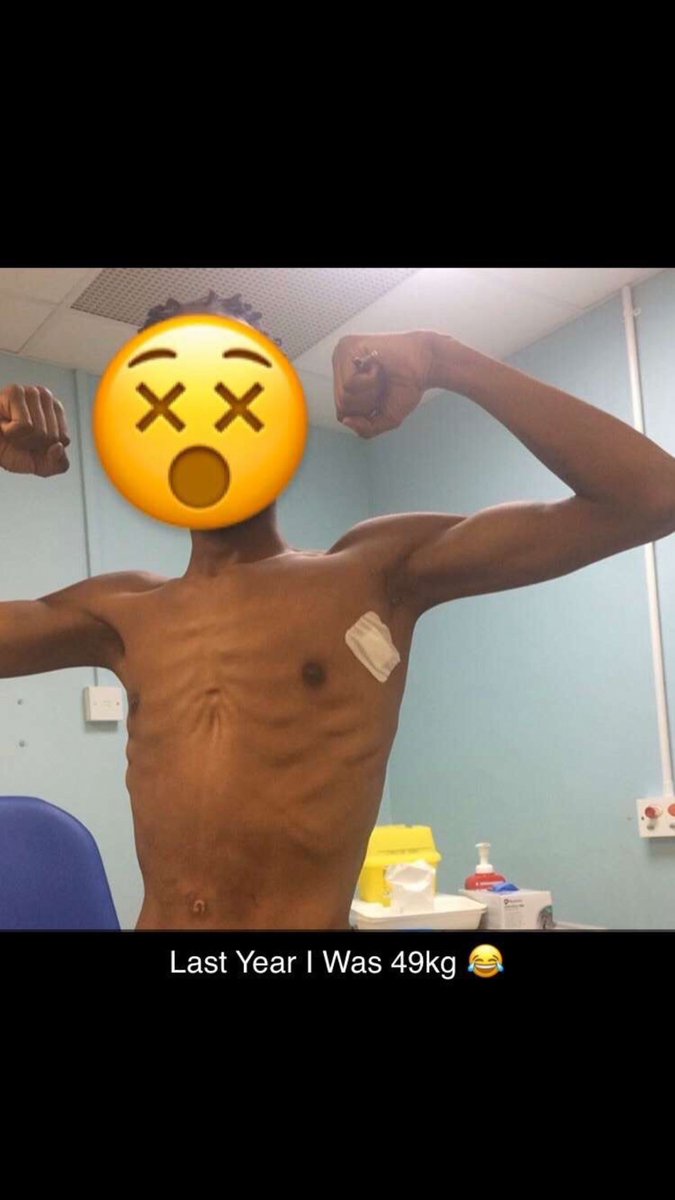 Rumwithkutz's tweet photo. One Year #Cancer Free 

Non Hodgkins #Lymphoma Stage 4

Anyone Who Has Been Through #Chemotherapy Especially The Intense Ones Knows It’s No Joke https://t.co/GQWcjT3e2m
