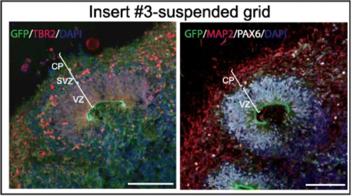 BMC_series's tweet photo. In their exciting study published in #BMCBiomedEng, researchers from the @TAOF_Lab @UniversitySA use 3D-printed microplate inserts to facilitate growth and imaging of brain organoids, treating us to these beautiful images: https://t.co/VElSoRXX8g https://t.co/VsbJkjia3T