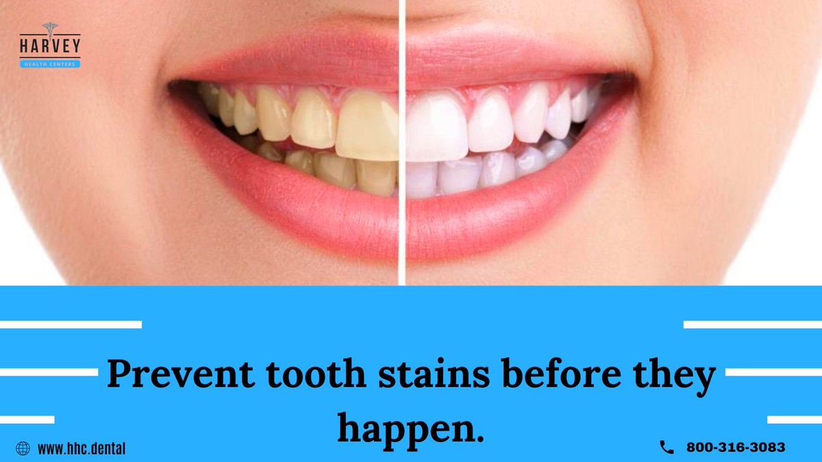 NelsonHarvey14's tweet photo. A person’s smile is one of the first parts of a face that people see.
Shop Now https://t.co/OzwoBcC2r0
#teeth #teethwhitening #teething #teethwhiteningkit #teethingbaby #teether #teethingnecklace #teethingsucks #teethers https://t.co/LS7YytNj1b