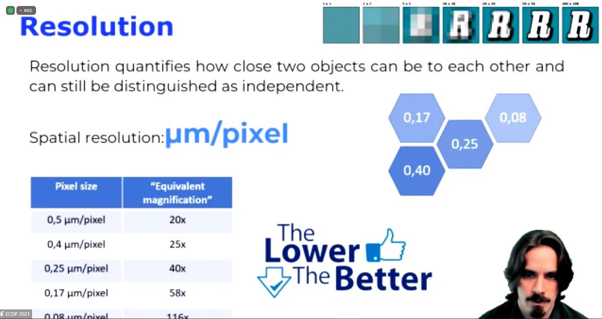 lara_pijuan's tweet image. Great talk about #digitalpathology in #cytology by @Tholthoron during 17th #ECDP2021 💪🏻 Yes, We can have digital cytology although the challenge of the sample 😅