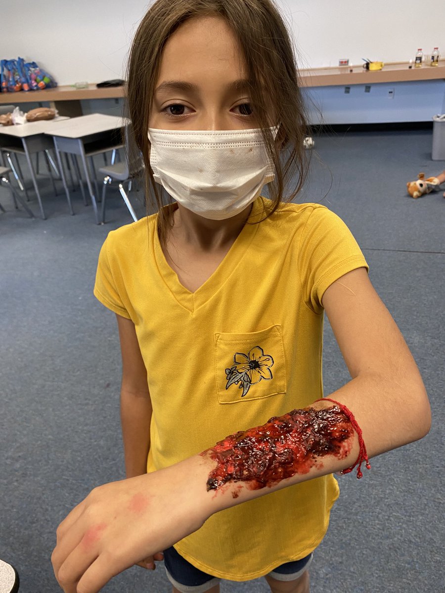 Enrichment Camp fun! Learning how to clean a wound properly #MVE_roadrunners #WeAreClintISD #MVEisHomeToMe