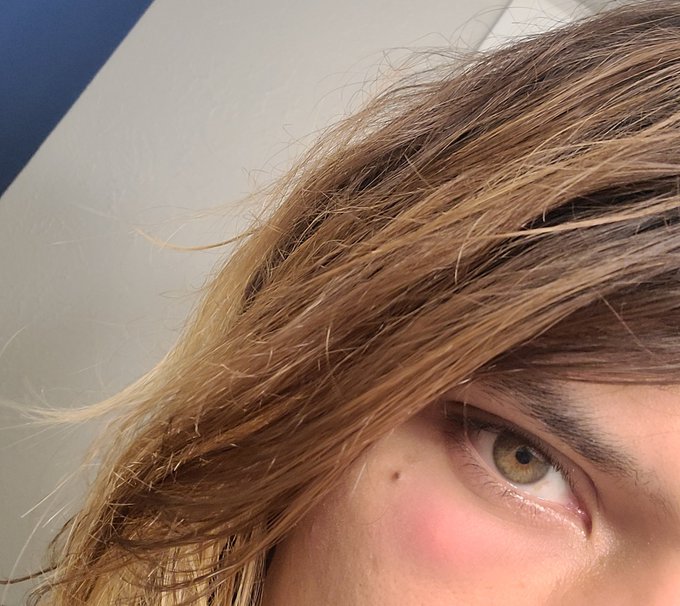 I hate mosquitos >-< https://t.co/90bxnHUPor