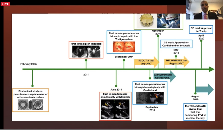Akhil Narang, MD (@akhilnarangmd) on Twitter photo <a href="/JyothyPuthumana/">Jyothy Puthumana</a> expertly reviews imaging the right heart. It's a multimodality effort between #EchoFirst, #WhyCMR, & #YesCCT. Understanding the TV annulus, leaflets, chordae, papillary muscles, RV, RA takes a village of imaging (and imagers). #ASE2021 <a href="/JyothyPuthumana/">Jyothy Puthumana</a> expertly reviews imaging the right heart. It's a multimodality effort between #EchoFirst, #WhyCMR, & #YesCCT. Understanding the TV annulus, leaflets, chordae, papillary muscles, RV, RA takes a village of imaging (and imagers). #ASE2021