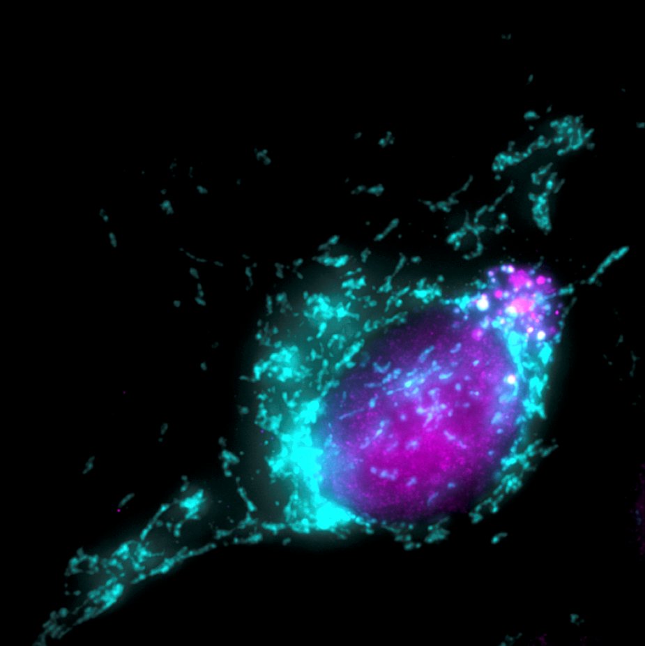 How does the actin #cytoskeleton impact programmed cell death?

King et al find that two WASP-family genes are necessary for rapid apoptotic responses

📰doi.org/10.1371/journa…
📷 human osteosarcoma cell undergoing #DNA damage-induced #apoptosis - #CCBY