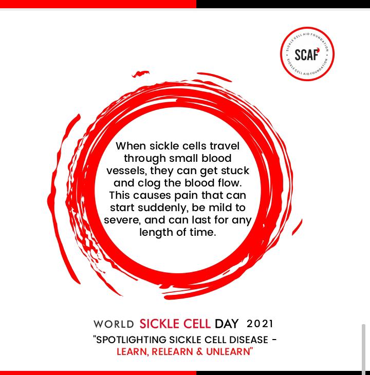Big_Jaro's tweet photo. Its World Sickle Cell Day 2021
#knowyourgenotype https://t.co/SXdlugAf25