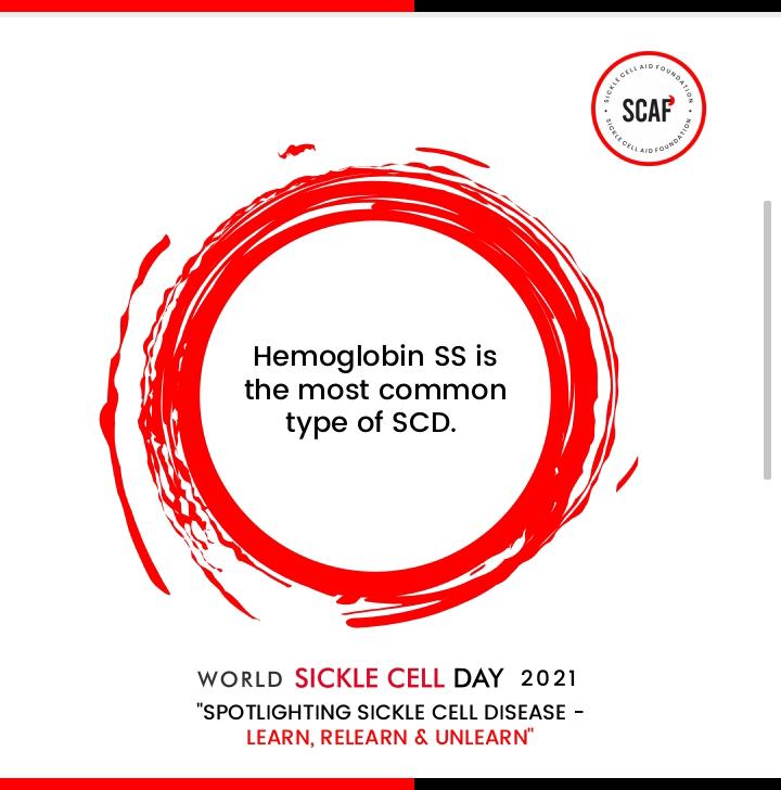 Its World Sickle Cell Day 2021
#knowyourgenotype