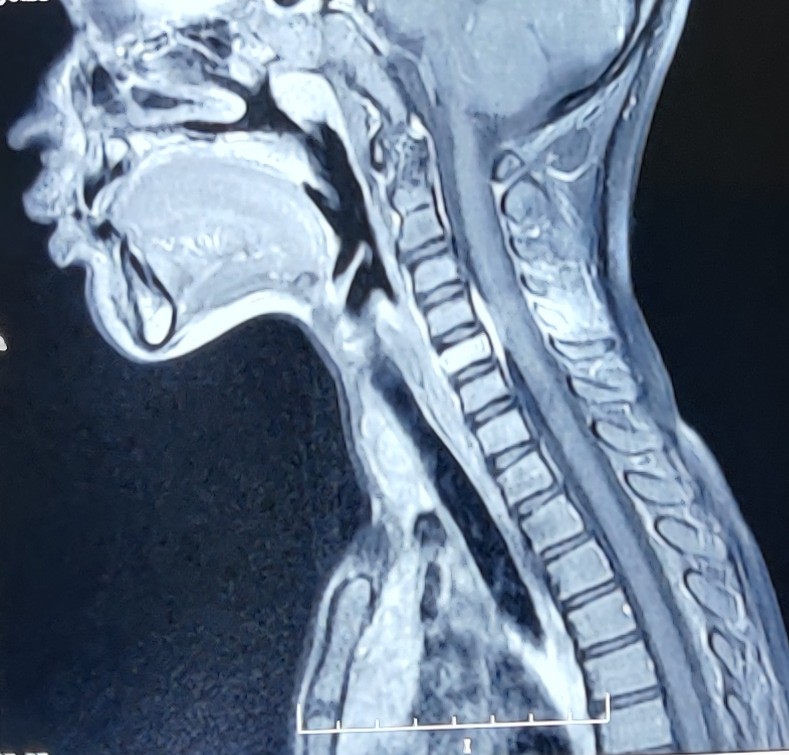 Suresh Kumar Angurana tweet media