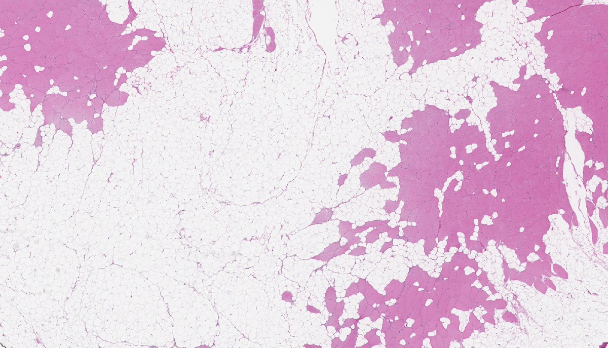 Brendan Dickson, MD tweet media