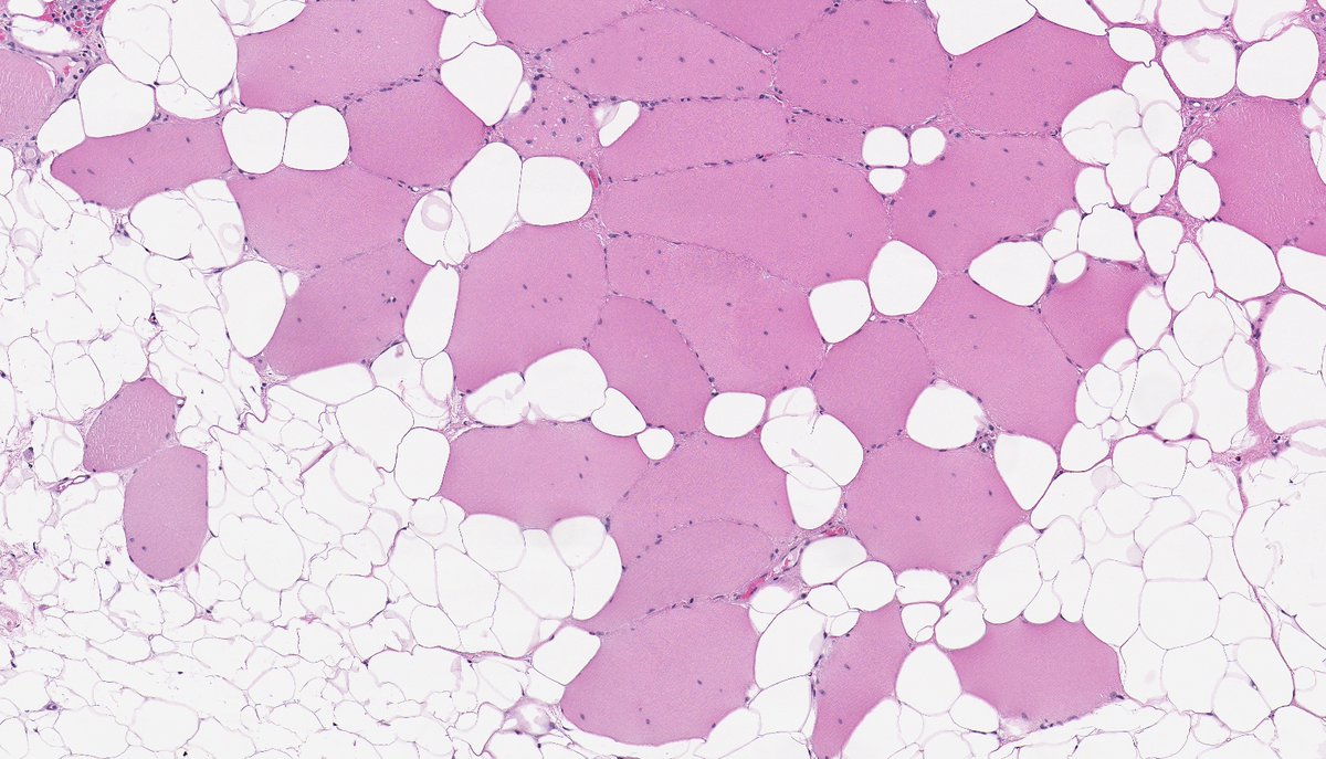 Brendan Dickson, MD tweet media