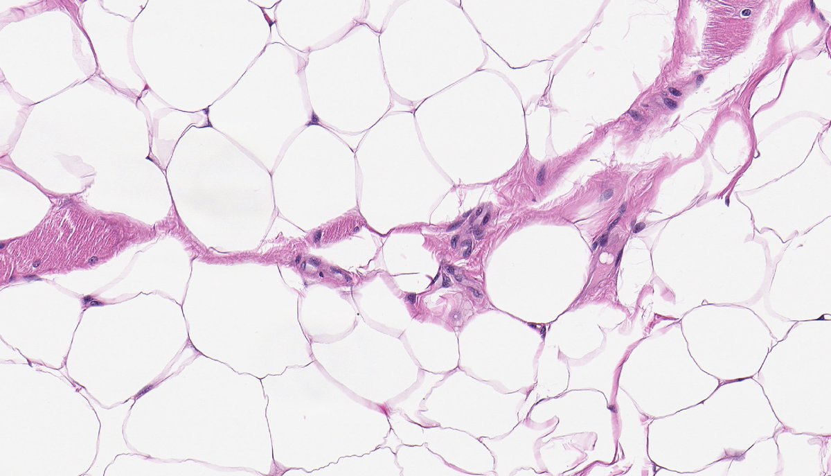 Brendan Dickson, MD tweet media