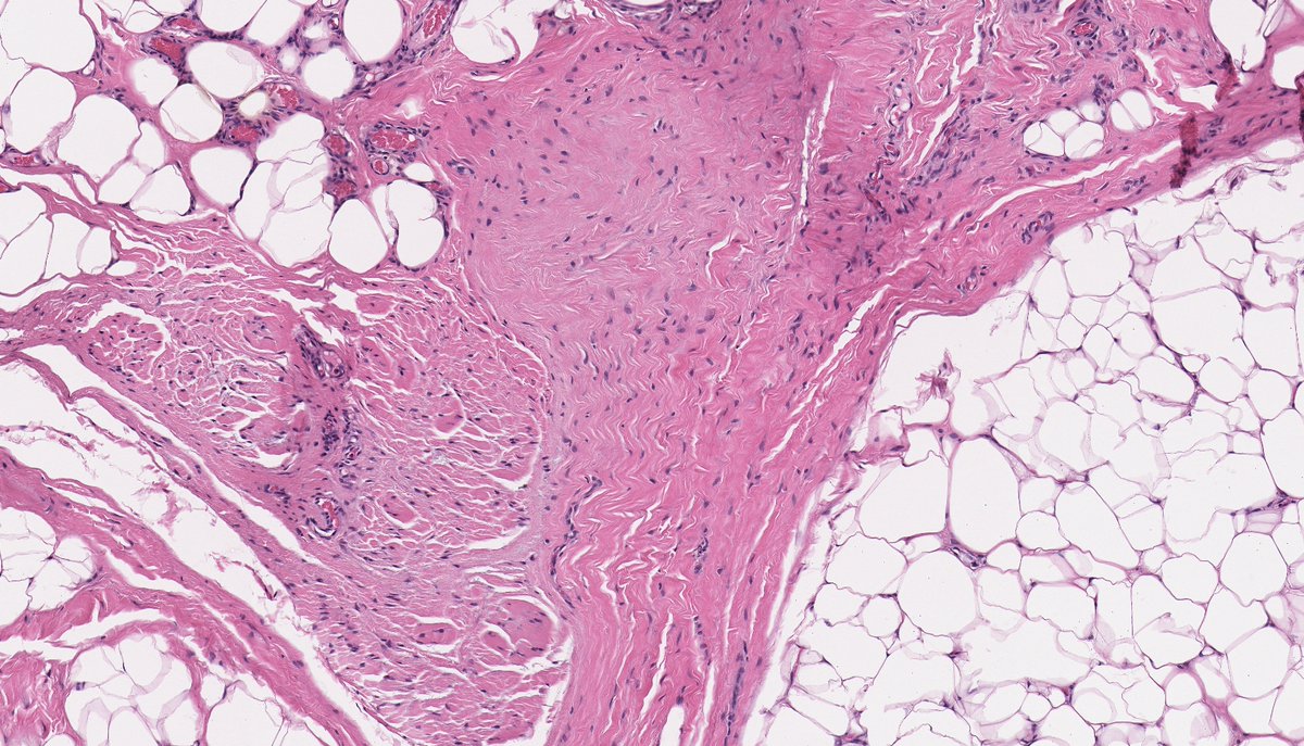 Brendan Dickson, MD tweet media