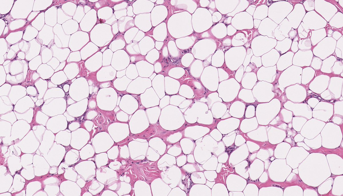 Brendan Dickson, MD tweet media