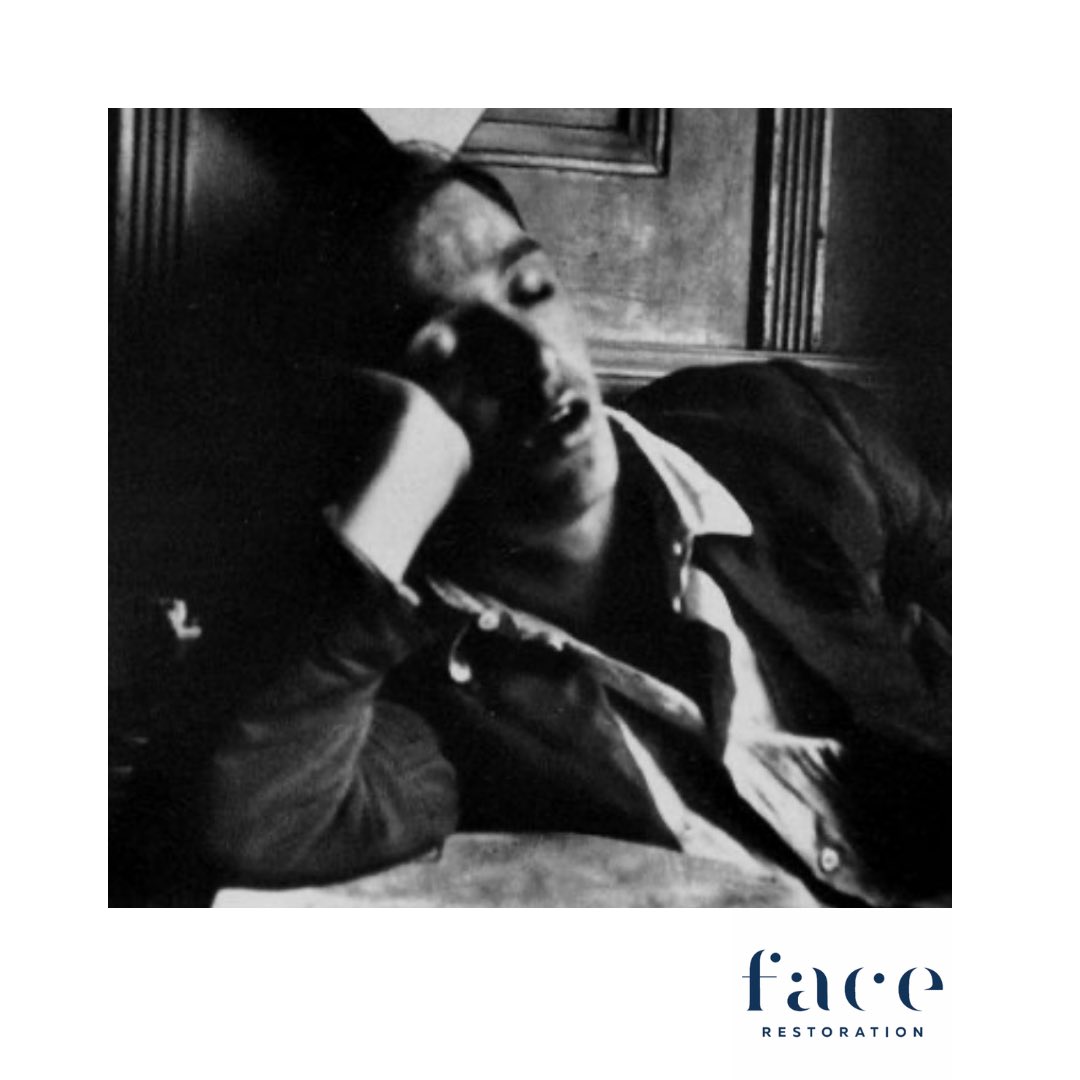 #menshealthweek2021 
Sleep Apnoea and Floppy Eyelid Syndrome - excess tiredness, heavy snoring, choking noises whilst sleeping, Irritable red eyes, droopy eyelids, Ptosis, an Increased risk of vision loss, stroke and heart failure - not something to ignore 
<a href="/rachna_murthy/">Rachna Murthy</a>