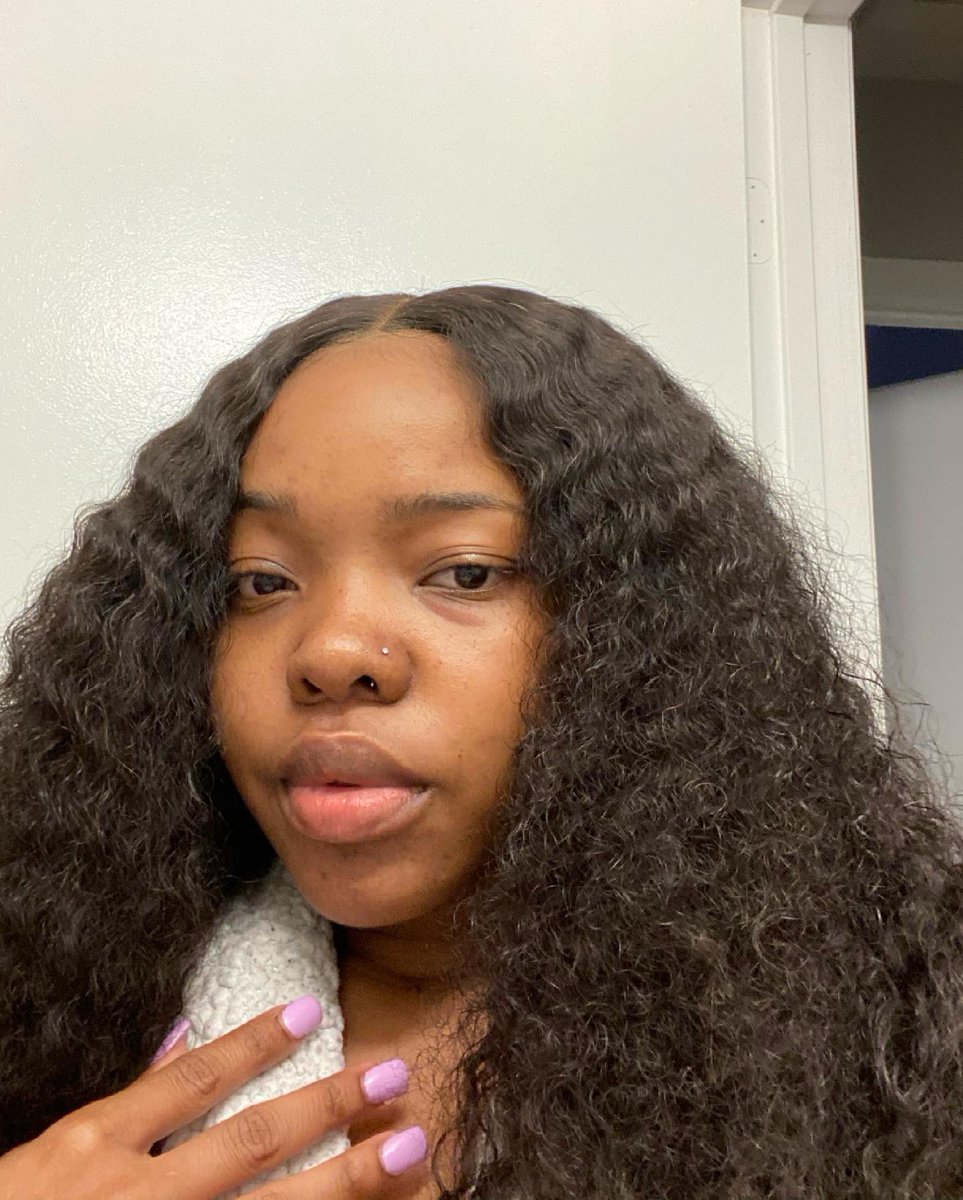 lifeoftty's tweet photo. skin is doing great btw.🥰 https://t.co/cgoopjeWHG