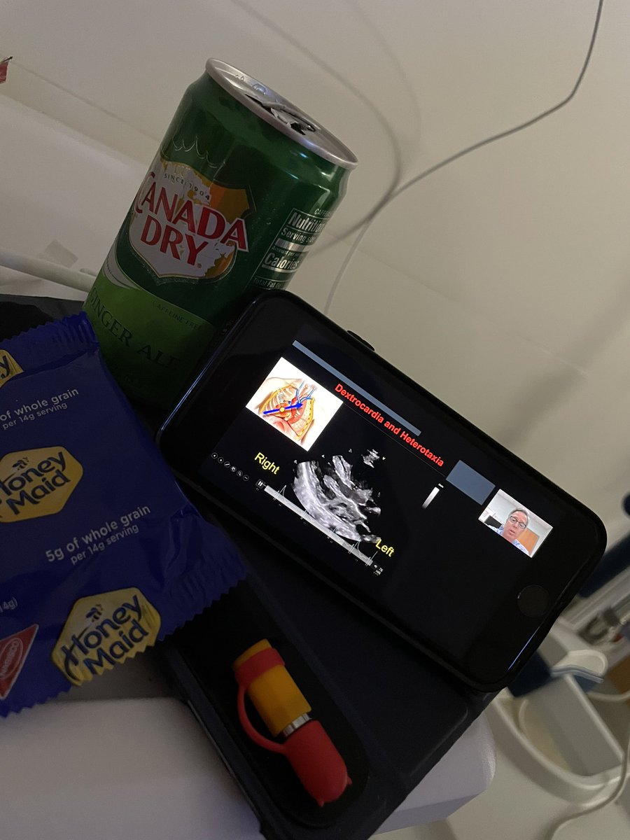 nehasonipatel's tweet photo. Another reason to love #VirtualEcho @ASE360…when you need to go to the ER but can’t miss my Ped Echo Peeps @MelisWasserman Joe Kreeger. Drink your water kids! #ASE2021 #EchoAtHome #IAmEchoNerd #PedEchoFTW #SonographerNotTech https://t.co/hhAsca1x31