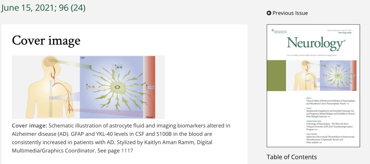 zimmerneurolab's tweet photo. Our meta-analyses evaluating #astrocyte biomarkers in #3,204 cognitively unimpaired and #alzheimer individuals (https://t.co/fZoWy3Q0qu) is the cover of the June 15th issue of the @GreenJournal 👉  https://t.co/vJ4iPjdQaY.  Congratulations to @BellaverBruna and all involved. + https://t.co/nPp3nNzcgi