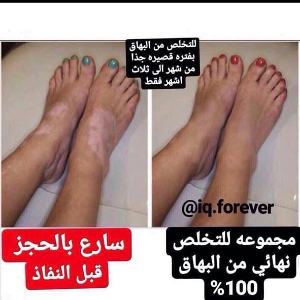 🇸🇦noov🇸🇦mohamad🇸🇦 tweet media