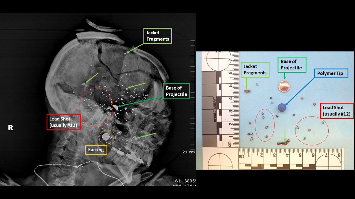 Emma Henrie, MD tweet media