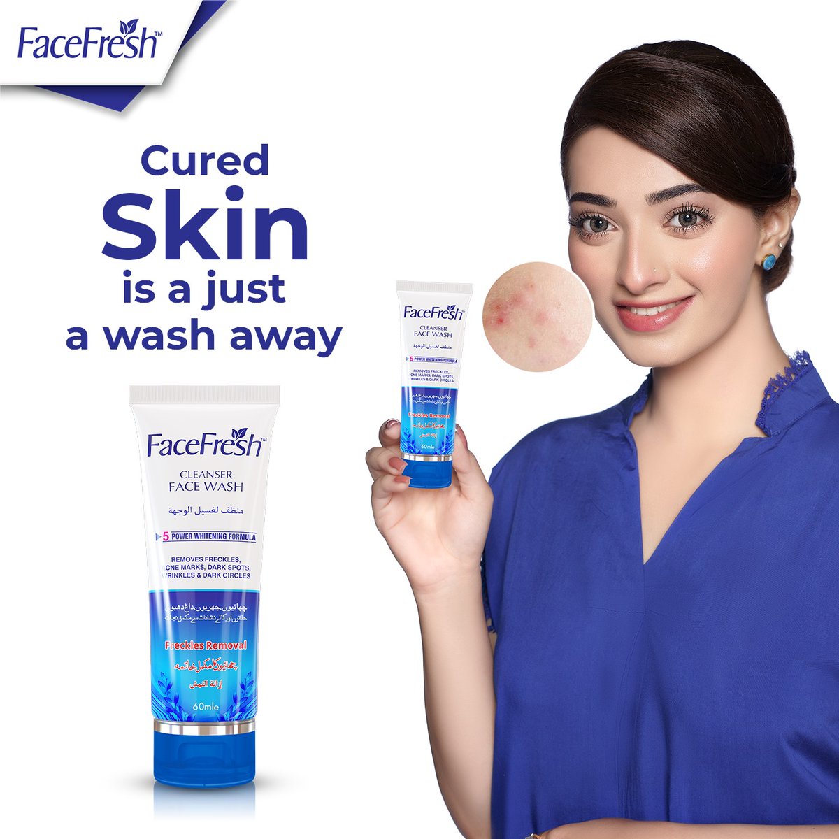 HumaraFm's tweet photo. Cure skin is just wash away with
Face Fresh Cleanser Face Wash.
#FaceFresh #CleanserFacewash #BestFaceWash https://t.co/ql42RYDJvR