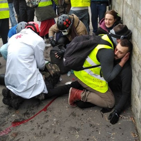 sbalcerac's tweet photo. Francja #Marcon. Sébastien Maillet stracił prawą dłoń od wybuchu policyjnego granatu ofensywnego #GLIF4 podczas manifestacji "żółtych kamizelek" w 2019 r. Sąd miłościwie przyznał mu 8 tys. Euro prowizorycznego odszkodowania. W końcu to tylko dłoń białasa. https://t.co/06CDtr7o8m https://t.co/4xSI2cxkpz