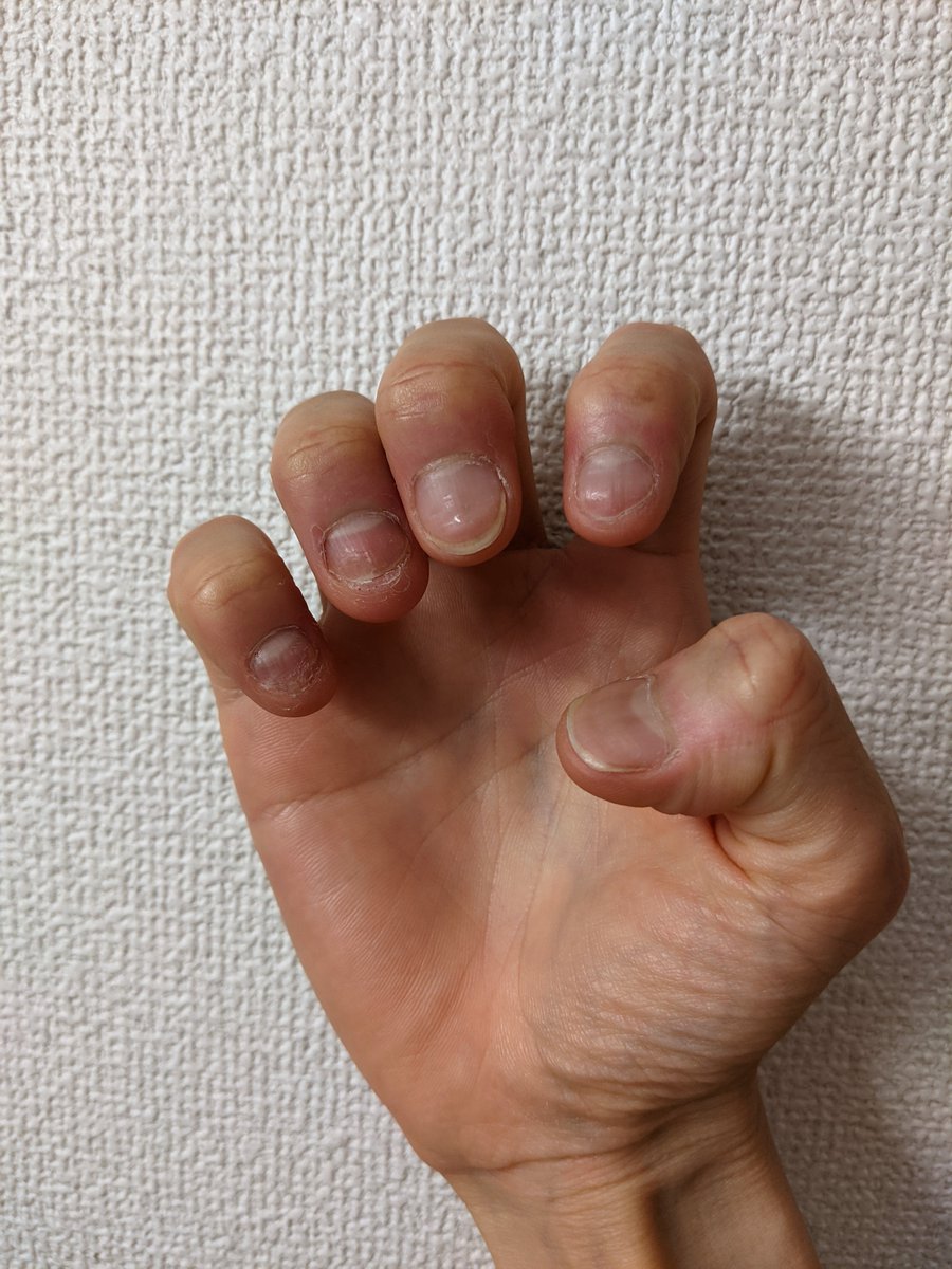 爪噛み男 Nail Biter Flat95 Twitter