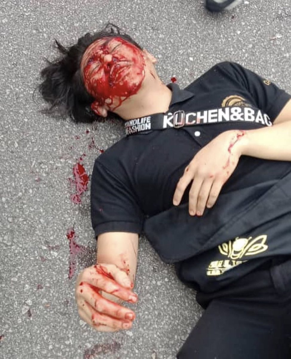 twt_muo's tweet photo. Semoga dipermudahkan urusan dan segera sembuh didoakan kepada adik Afiq serta hukuman yang sewajarnya kepada si pelaku. https://t.co/lKQunonKSF