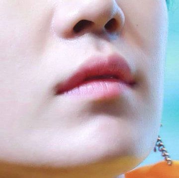 why are his lips so-