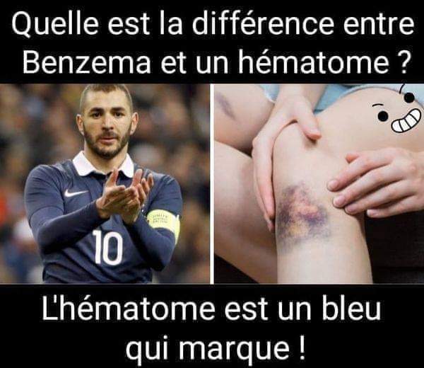 HumourNoir_Off's tweet photo. 🤣🤣🤣 #equipedefrance #EURO2020 #Euro2021 #Benzema #humournoir https://t.co/klF8qTCWjA