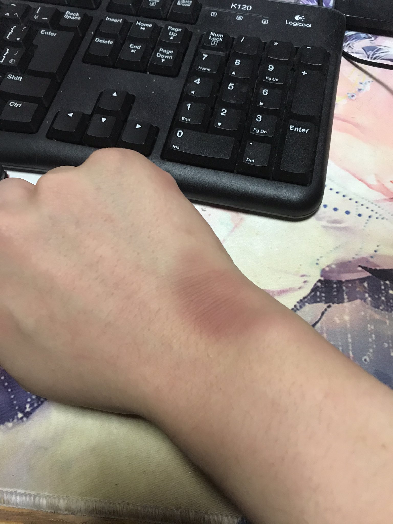 ユニバース師匠 台パンし過ぎて青あざになってきた T Co Ohud7gnp5b Twitter