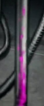 scoliosis is coming for me help tweet media