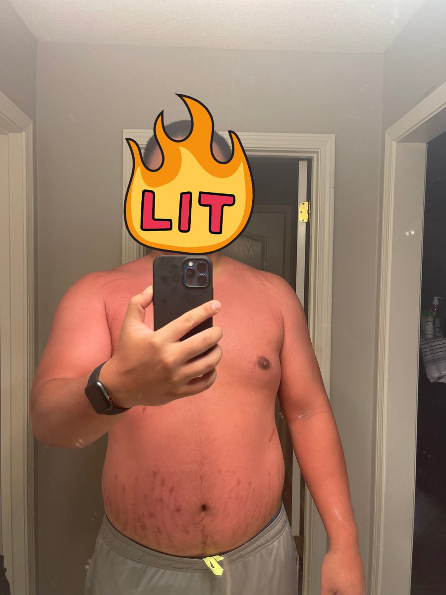 misterhwang's tweet photo. Never seen myself this shade before https://t.co/uOBZNe1IoP