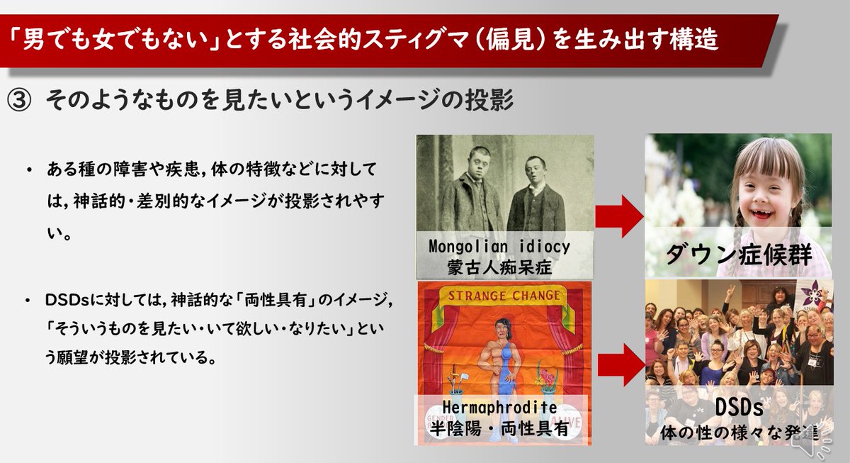 Dsds 体の性の様々な発達 性分化疾患 に対する偏見 ハーマフロダイトイメージ とは Twitter