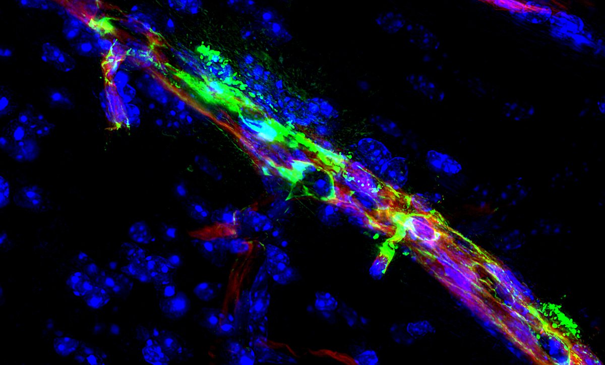 The endothelium puts a brake to cytokine signaling to prevent endotheliopathy and multiorgan dysfunction. Want to learn more? Nina’s paper is out as an in-press preview @JCI_Insight! Thank you to all the amazing collaborators at @AlbanyMedMCP!
insight.jci.org/articles/view/… 👇📜