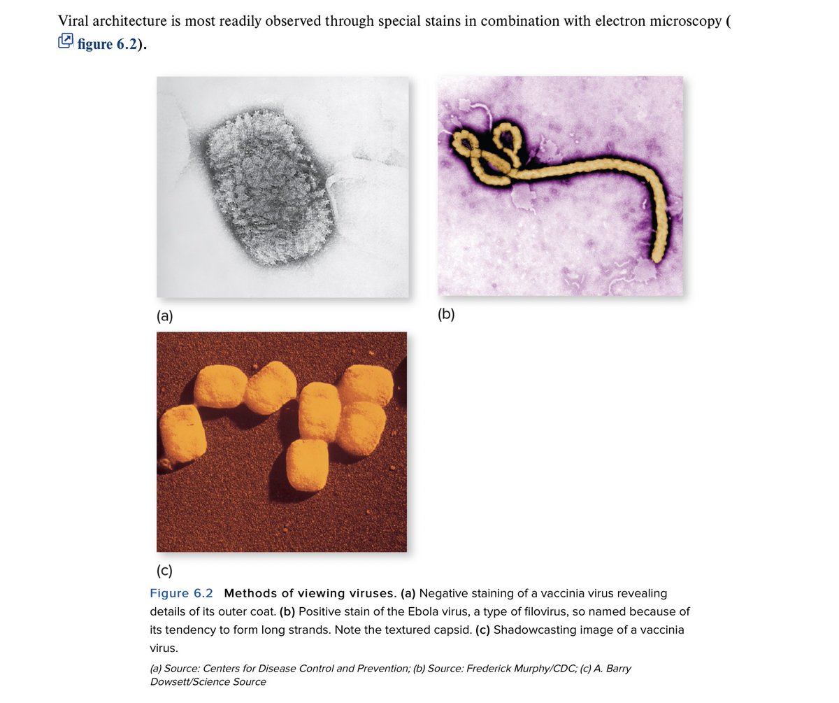 amber_ogi's tweet photo. Why does this virus look like a delicious cheese puff https://t.co/Mz8feqbdbr