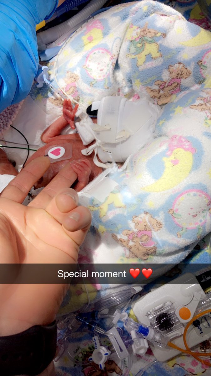 My beautiful daughter Elsie Hampson born 17 weeks early weighing 528 grams ❤️ We have set up an Instagram to document her journey in the Nicu ward if you could go follow @ELSIES_NICUJOURNEY on there that would be amazing, please RT to as many people as possible ❤️❤️
