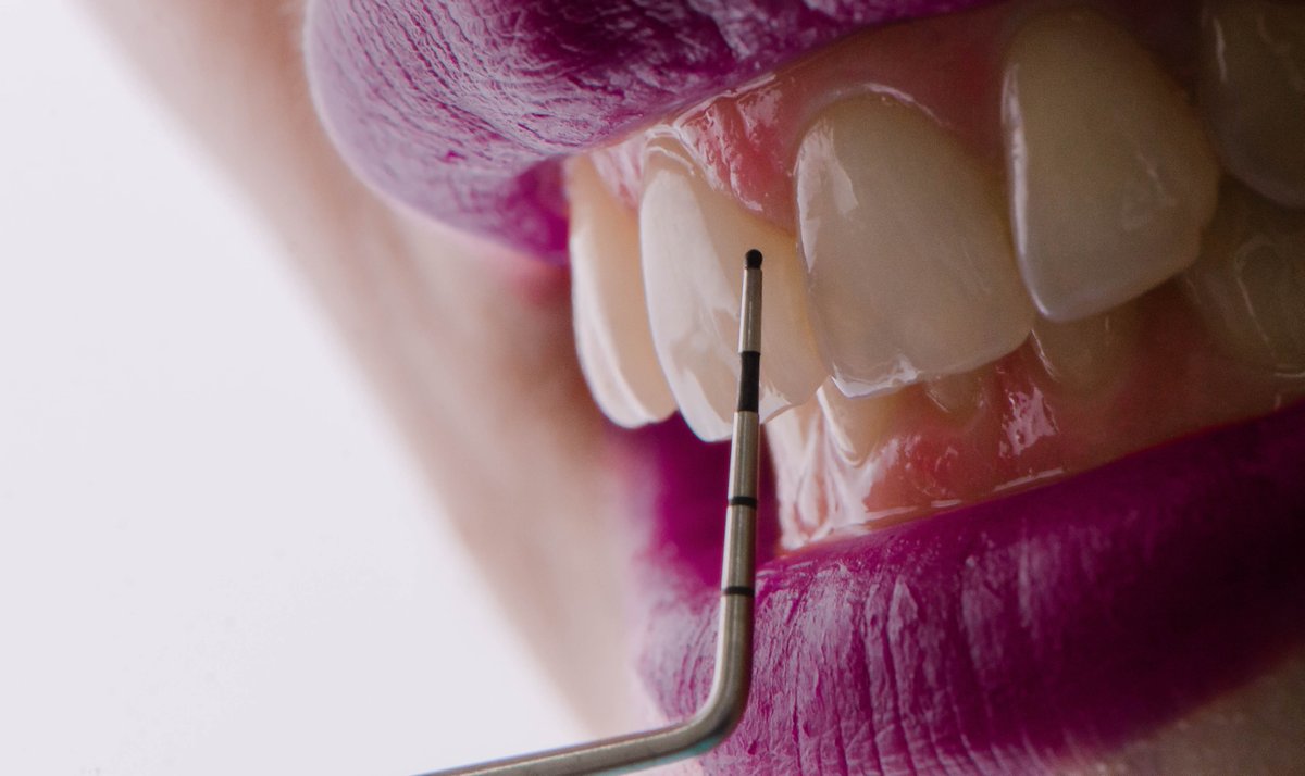 draliceheng's tweet image. colouring your lips with adobe photoshop software. Learning is a never ending story. 
#myteeth #secondlesson #adobephotoshop #gums #lips #purple