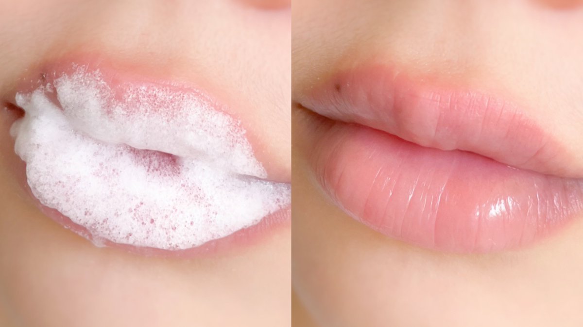 gmmgamm's tweet photo. มาแนะนำไอเท็มสำหรับสาวปากแห้ง Bubi Bubi Bubble Lip Scrub 💗 กลิ่นพีชหอมมากกก พอทาเจลลงไปจะเกิดเป็นฟอง นุ่มนวลๆ พอฟองลดลง ใช้นิ้วถูเบาๆ แล้วล้างออกด้วยน้ำหรือเช็ดด้วยทิชชู่เปียกได้เลย ขุยๆก็จะออกไปหมด หลังทำบ่อยๆริมฝีปากดูอมชมพู แถมชุ่มชื้นขึ้นมักก #ใช้ดีบอกต่อ https://t.co/H07ddnEUhi