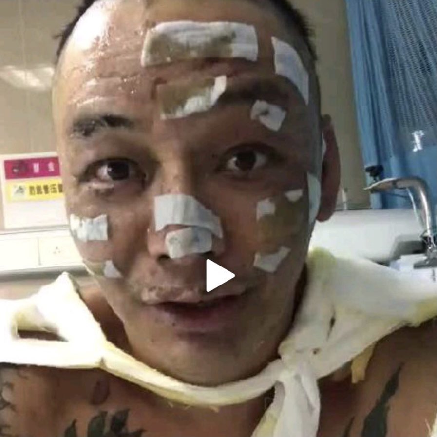 daociusyu's tweet image. #2real #徐真真 全身二级深度烧伤，85年4月4日癸酉坐偏印，金神，外表柔和，内心多谋。富于心计，会挣钱，但也会花钱，社会交往，多有人爱
#锦鲤于道长 #follow4follow #follow #相互フォロー #相互100 #followback #FollowMe #互粉 #互fo #Koi #DaociusYu #道教 #تائویسم #도교 #ลัtทธิเต๋า #Ταοϊσμός