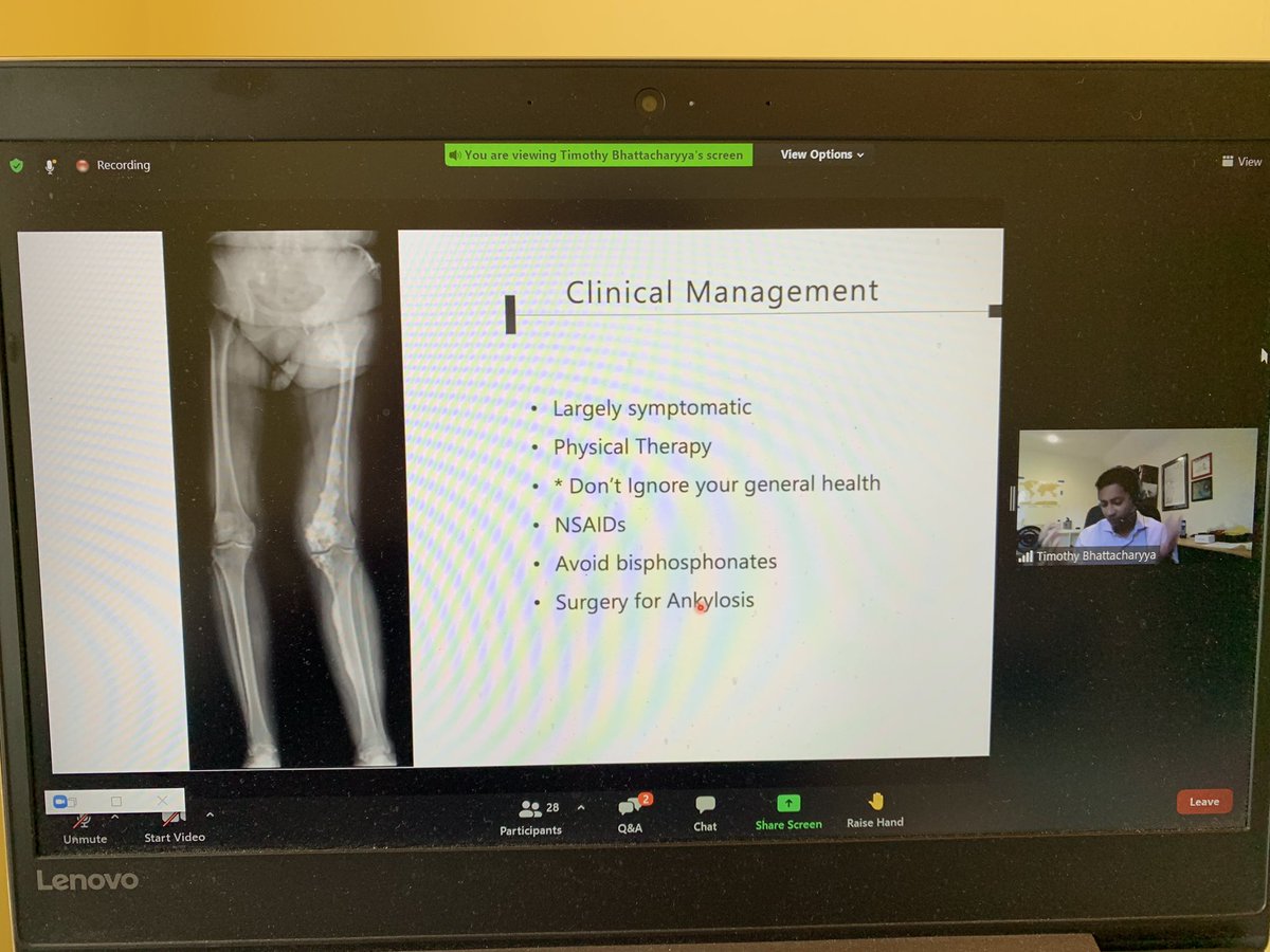 RNOH Centre for Metabolic Bone Disease (@rnohmbdcentre) on Twitter photo Really great talk on Melorrheostosis at the rare bone workshop by <a href="/drbhattortho/">Timothy Bhattacharyya MD</a> Amazing work #BRS2021 Really great talk on Melorrheostosis at the rare bone workshop by <a href="/drbhattortho/">Timothy Bhattacharyya MD</a> Amazing work #BRS2021